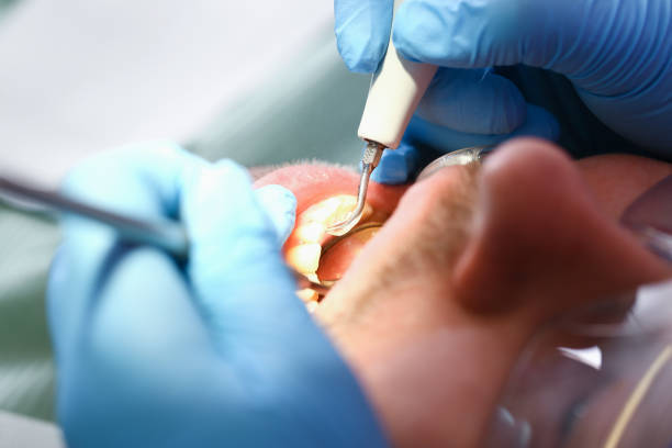 Best Chipped Tooth Repair Near Me  in Gothenburg, NE