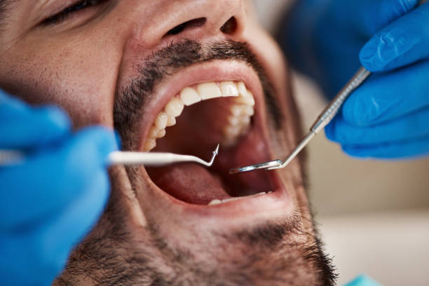 Best Emergency Tooth Extraction  in Gothenburg, NE