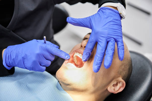 Best Cracked Tooth Emergency Dentist  in Gothenburg, NE