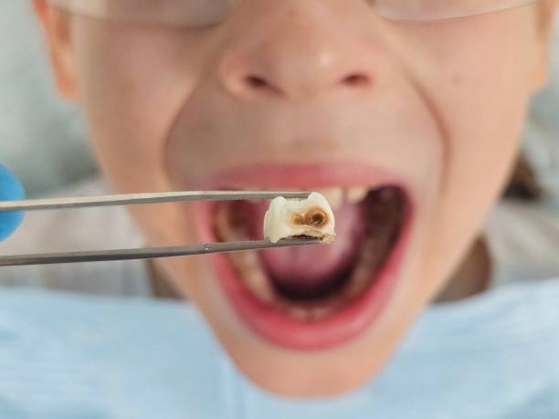 Best Dentist for Dental Trauma  in Gothenburg, NE